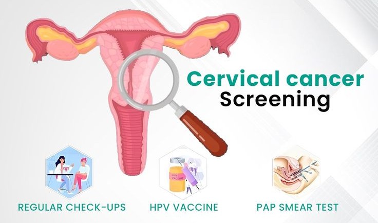 Cervical Cancer Screening